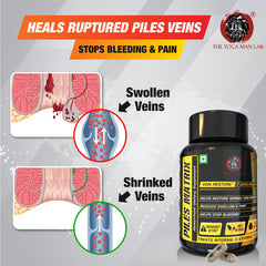 PILES MATRIX - Vein Restore + Rectum Restore Ayurvedic Supplements + Herbal Remedies Diet Booklet | Relives Pain & Shrinks Mass | 100% Natural