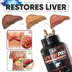 Liver Pro - Fatty Liver Ayurvedic Supplement | Helps Restore Liver Health & Remove Toxins | 100% Natural & Ayurvedic | 28 Days Program