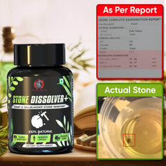 STONE DISSOLVER+ Ayurvedic Stone Remover Supplement | Relieves Pain, Breaks All Types Of Stones, Fast Acting | 100% Natural