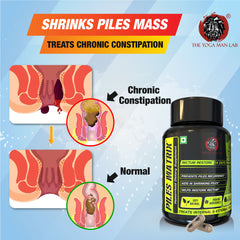 PILES MATRIX - RECTUM RESTORE Ayurvedic Supplement | Removes Root Cause. Shrinks Piles Lumps & Treats Constipation | 100% Natural